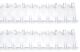 Cinch Wires .75 inch 2 Per Pkg White